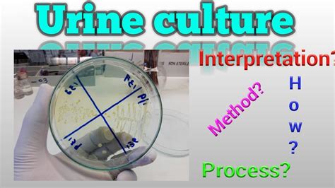urine cs test meaning|Urine Culture Test .